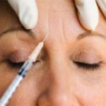 Botox — The end of the Dynamic Wrinkle